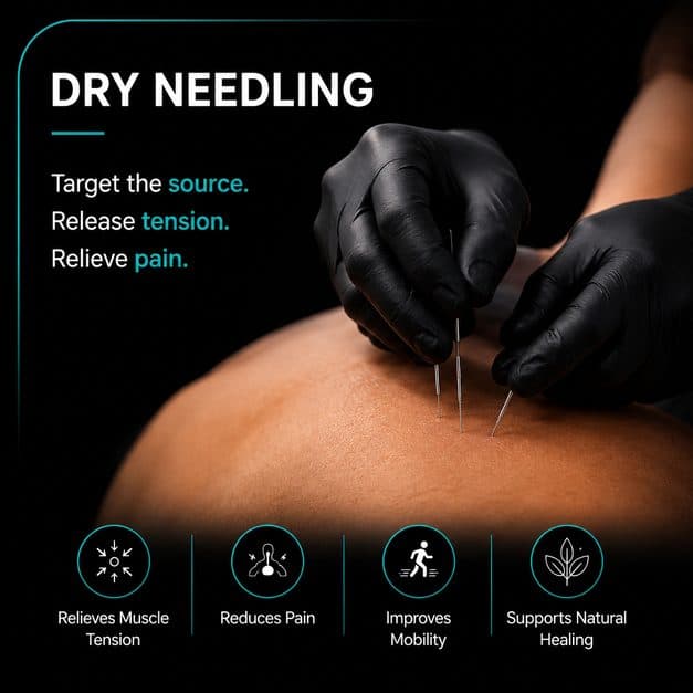 Dry Needling at F1T Medical